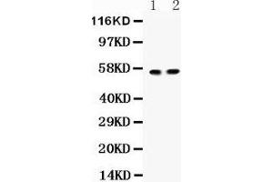 Anti- ICA1 Picoband antibody, Western blotting All lanes: Anti ICA1  at 0.