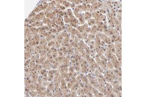 Immunohistochemical staining of human liver with WSB1 polyclonal antibody  shows cytoplasmic and membranous positivity in hepatocytes at 1:50-1:200 dilution. (WSB1 抗体)