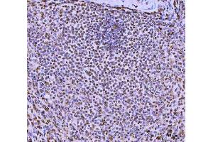 IHC analysis of FIP1L1 using anti-FIP1L1 antibody (ABIN7600761). (FIP1L1 抗体  (AA 23-558))