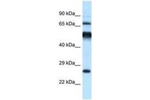 Image no. 1 for anti-Kelch-Like 1 (KLHL1) (AA 396-445) antibody (ABIN6747517) (KLHL1 抗体  (AA 396-445))