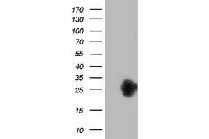Western Blotting (WB) image for anti-Zinc Finger, AN1-Type Domain 2B (ZFAND2B) antibody (ABIN1501808) (ZFAND2B 抗体)