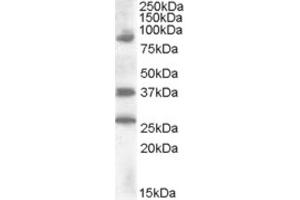 Western Blotting (WB) image for anti-Homeobox D10 (HOXD10) (Internal Region) antibody (ABIN2466797) (HOXD10 抗体  (Internal Region))