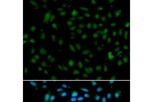 Immunofluorescence analysis of A549 cells using WHSC1L1 Polyclonal Antibody (WHSC1L1 抗体)