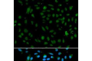 Immunofluorescence analysis of A549 cells using WHSC1L1 Polyclonal Antibody (WHSC1L1 抗体)