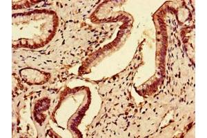 Immunohistochemistry (IHC) image for anti-Solute Carrier Family 7 (Amino Acid Transporter Light Chain, Y+L System), Member 7 (Slc7a7) (AA 325-382) antibody (ABIN7175933)