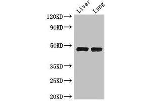 Western Blot Positive WB detected in: Mouse liver tissue, Mouse lung tissue All lanes: SEC14L3 antibody at 3 μg/mL Secondary Goat polyclonal to rabbit IgG at 1/50000 dilution Predicted band size: 47 kDa Observed band size: 47 kDa (SEC14L3 抗体  (AA 201-400))