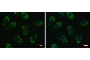 ICC/IF Image UQCRFS1 antibody [N1C3] detects UQCRFS1 protein at mitochondria by immunofluorescent analysis. (UQCRFS1 抗体)