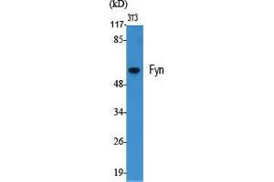 Western Blot (WB) analysis of specific cells using Fyn Polyclonal Antibody. (FYN 抗体  (Ser400))