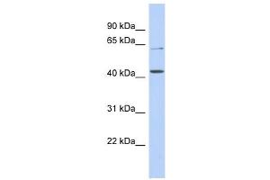 SLC22A12 antibody used at 1 ug/ml to detect target protein. (SLC22A12 抗体)