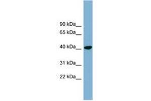 Image no. 1 for anti-PIN2/TERF1 Interacting, Telomerase Inhibitor 1 (PINX1) (AA 35-84) antibody (ABIN6744111)