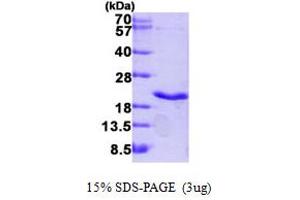 SDS-PAGE (SDS) image for Lymphotoxin-alpha (LTA) (AA 35-205) protein (His tag) (ABIN667775)