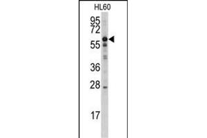 Western blot analysis of anti-MTM1 Antibody (N-term) (ABIN1882103 and ABIN2841036) in HL60 cell line lysates (35 μg/lane). (MTM1 抗体  (N-Term))