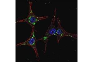 Fluorescent confocal image of HeLa cells stained with SYVN1 antibody. (SYVN1 抗体  (AA 586-617))