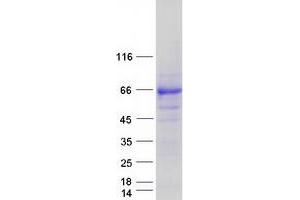 Western Blotting (WB) image for Adrenocortical Dysplasia Homolog (ACD) (Transcript Variant 2) protein (Myc-DYKDDDDK Tag) (ABIN2714316)