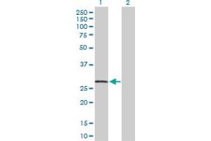 Western Blot analysis of CDKN1A expression in transfected 293T cell line by CDKN1A MaxPab polyclonal antibody. (p21 抗体  (AA 1-164))