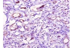 Immunohistochemistry of paraffin-embedded human kidney tissue using ABIN7149376 at dilution of 1:10 (NT5C1A 抗体  (AA 1-368))