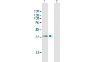 Western Blot analysis of ZPBP2 expression in transfected 293T cell line by ZPBP2 MaxPab polyclonal antibody. (ZPBP2 抗体  (AA 1-315))