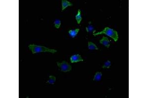 Immunofluorescence staining of SH-SY5Y cells with ABIN7167314 at 1:50, counter-stained with DAPI.