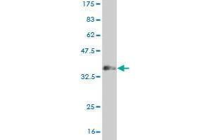 Western Blot detection against Immunogen (36. (MUSK 抗体  (AA 301-400))