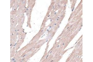 Immunohistochemistry of paraffin-embedded Mouse heart using PPT2 Polyclonal Antibody at dilution of 1:100 (40x lens). (PPT2 抗体)
