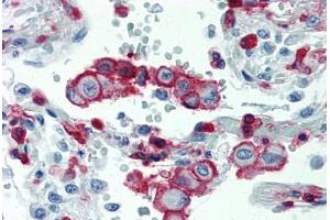 Lung, Human: Formalin-Fixed, Paraffin-Embedded (FFPE) (Integrin beta 2 抗体  (AA 534-546))