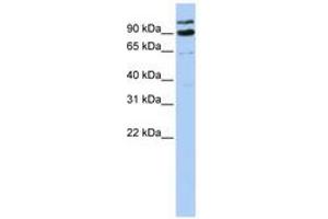 Image no. 1 for anti-LON Peptidase N-terminal Domain and Ring Finger 3 (LONRF3) (AA 612-661) antibody (ABIN6740816) (LONRF3 抗体  (AA 612-661))