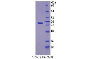 SDS-PAGE analysis of Human FLRT1 Protein. (FLRT1 蛋白)