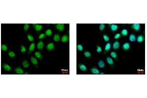 ICC/IF Image BS69 antibody detects ZMYND11 protein at nucleus by immunofluorescent analysis. (ZMYND11 抗体)