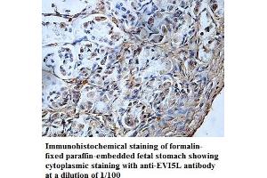 Image no. 1 for anti-Ecotropic Viral Integration Site 5-Like (EVI5L) antibody (ABIN1576395) (EVI5L 抗体)