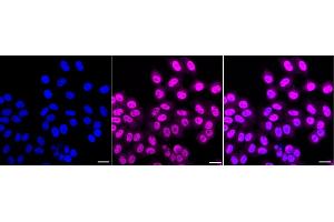 anti-Nonhomologous End-Joining Factor 1 (NHEJ1) antibody