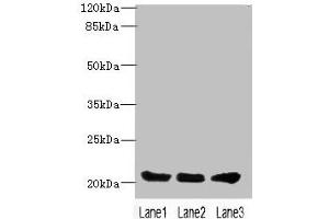 Western blot All lanes: PLLP antibody at 4 μg/mL Lane 1: Mouse gonadal tissue Lane 2: Mouse kidney tissue Lane 3: Mouse lung tissue Secondary Goat polyclonal to rabbit IgG at 1/10000 dilution Predicted band size: 20 kDa Observed band size: 20 kDa (Plasmolipin 抗体  (AA 1-35))