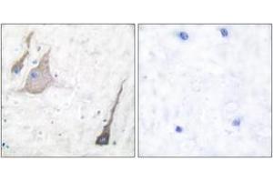 Immunohistochemistry analysis of paraffin-embedded human brain tissue, using Synuclein-pan Antibody. (Synuclein 抗体  (AA 15-64))