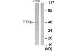 Western blot analysis of extracts from LOVO cells, using Breast Tumor Kinase Antibody.