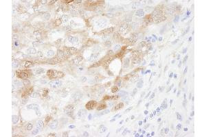 Immunohistochemistry (IHC) image for anti-Cellular Retinoic Acid Binding Protein 2 (CRABP2) (C-Term) antibody (ABIN7448487)