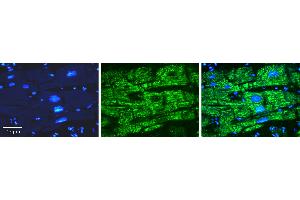 Rabbit Anti-OPTN Antibody   Formalin Fixed Paraffin Embedded Tissue: Human heart Tissue Observed Staining: Cytoplasmic Primary Antibody Concentration: N/A Other Working Concentrations: 1:600 Secondary Antibody: Donkey anti-Rabbit-Cy3 Secondary Antibody Concentration: 1:200 Magnification: 20X Exposure Time: 0. (OPTN 抗体  (N-Term))