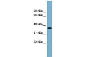 NEURL2 anticorps  (AA 143-192)