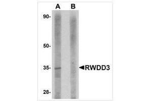 Western blot analysis of RWDD3 in rat kidney tissue lysate with RWDD3 antibody at 1 μg/ml in (A) the absence and (B) the presence of blocking peptide.