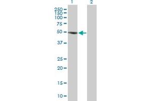 Western Blot analysis of SOCS5 expression in transfected 293T cell line by SOCS5 MaxPab polyclonal antibody. (SOCS5 抗体  (AA 1-536))