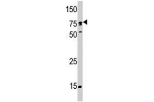 Western blot analysis of SCYL2 polyclonal antibody  in T-47D . (SCYL2 抗体  (C-Term))