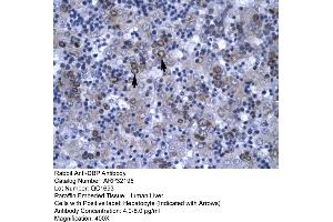 Human Liver (DBP 抗体  (N-Term))