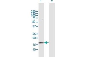 Western Blotting (WB) image for anti-Glutamate Receptor, Ionotropic, N-Methyl D-Aspartate 2c (GRIN2C) (AA 1-171) antibody (ABIN516199)