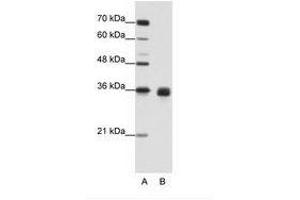 Image no. 2 for anti-Wingless-Type MMTV Integration Site Family, Member 2B (WNT2B) (AA 229-278) antibody (ABIN203089) (WNT2B 抗体  (AA 229-278))