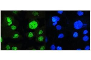 IF analysis of MED15 using anti-MED15 antibody (ABIN6719342).