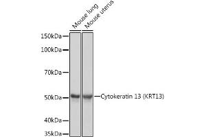 Western blot analysis of extracts of various cell lines, using Cytokeratin 13 (KRT13) (KRT13) Rabbit mAb (ABIN7268089) at 1:1000 dilution. (Cytokeratin 13 抗体)