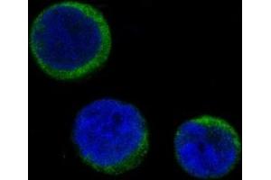 Immunofluorescent analysis of Jurkat cells, using Ferritin Antibody. (Recombinant Ferritin 抗体)