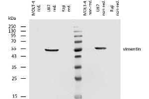 Western blotting analysis of human vimentin using mouse monoclonal antibody VI-RE/1 on lysates of MOLT-4 cell line (low expression), U87 cell line (positive) and Raji cell line (negative control) under non-reducing and reducing conditions. (Vimentin 抗体)