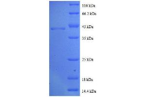 SDS-PAGE (SDS) image for Cytidine Deaminase (CDA) (AA 1-146), (full length) protein (GST tag) (ABIN618727) (CDA Protein (AA 1-146, full length) (GST tag))
