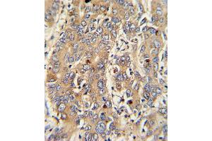 Immunohistochemistry (IHC) image for anti-Stathmin 1 (STMN1) (AA 646-672), (C-Term) antibody (ABIN5533193)