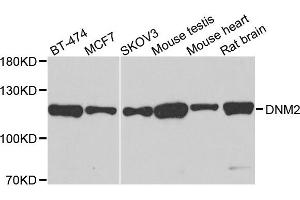 Western blot analysis of extracts of various cells, using DNM2 antibody. (DNM2 抗体)
