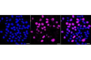 Immunocytochemical staining of HepG2 cells with Kinesin family member C1 antibody (ABIN7799209), 1:). (Recombinant KIFC1 抗体)